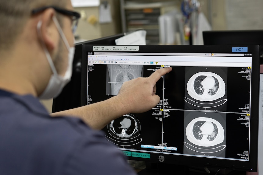 A man in dark blue scrubs points at a lung scan on a computer 