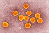 The hepatitis C virus.