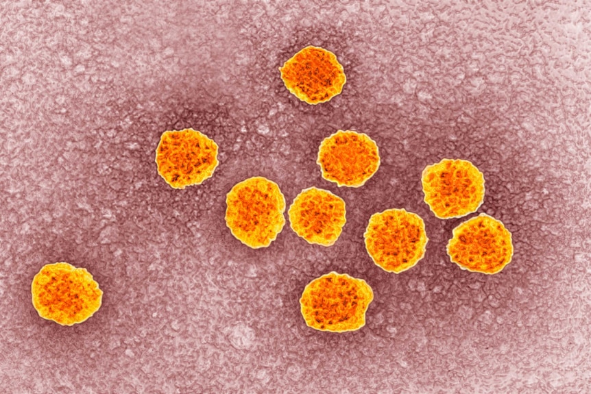 The hepatitis C virus