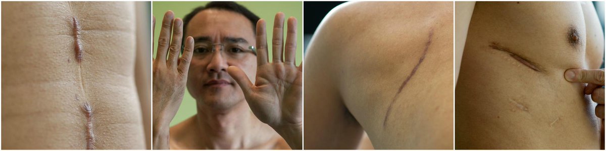 Stabbed 14 times: Surgeon's hospital security plea - ABC listen