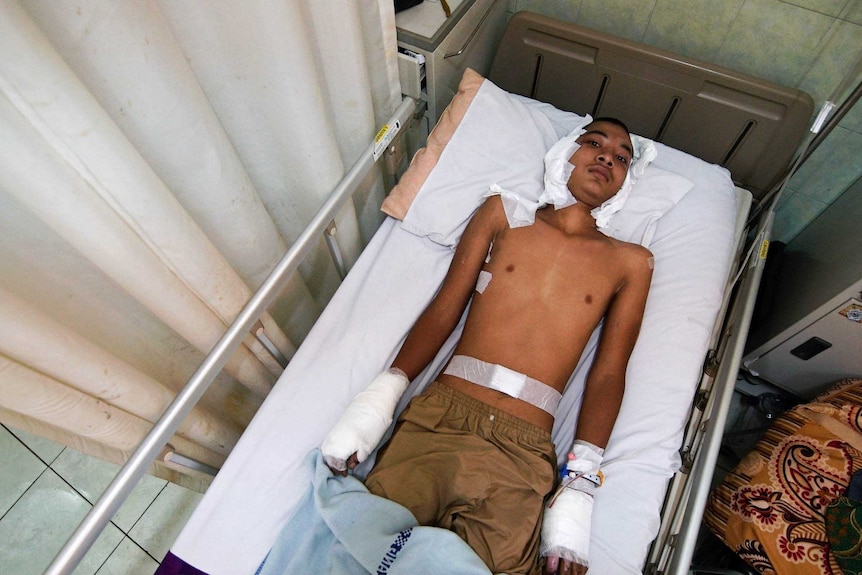 Young boy lies on a hospital bed with bandages all over his body