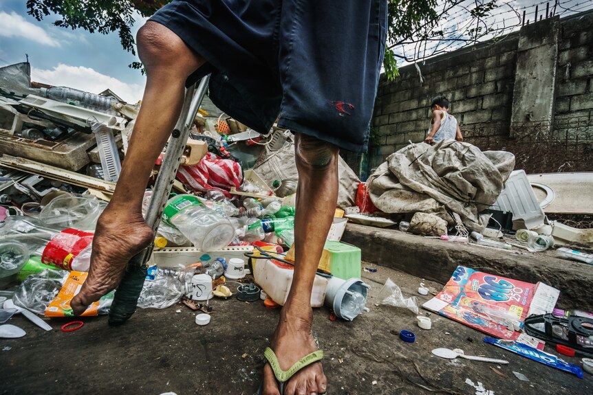A man with polio who lives in a Manila junkyard shows how his legs have been affected.