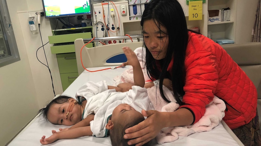 A mother in a red jacket cradles the head of one of two conjoined twins on a hospital bed.