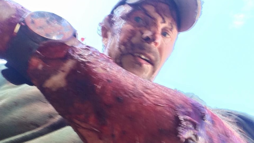 US man, Todd Orr documents injuries after being attacked by a grizzly bear in Montana. October 2016.