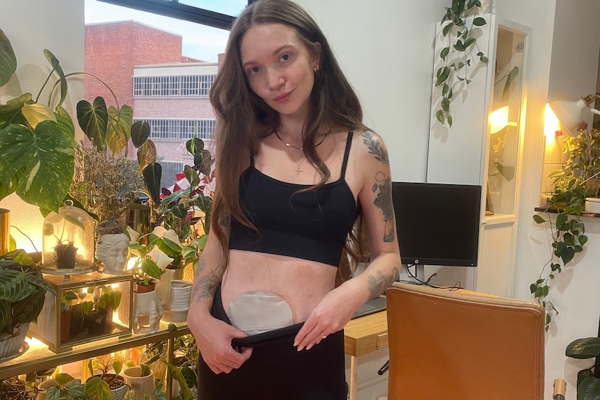 Aylee wears activeware, pulling down her leggings to show her stoma bag.