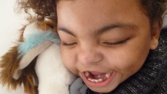 Close-up photo of profoundly disabled child, Chanté, holding a stuffed rabbit.