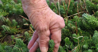 Hands with arthritis touching plants
