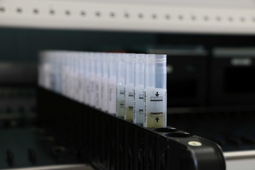 Medical samples stored in test tubes at ACT Pathology.