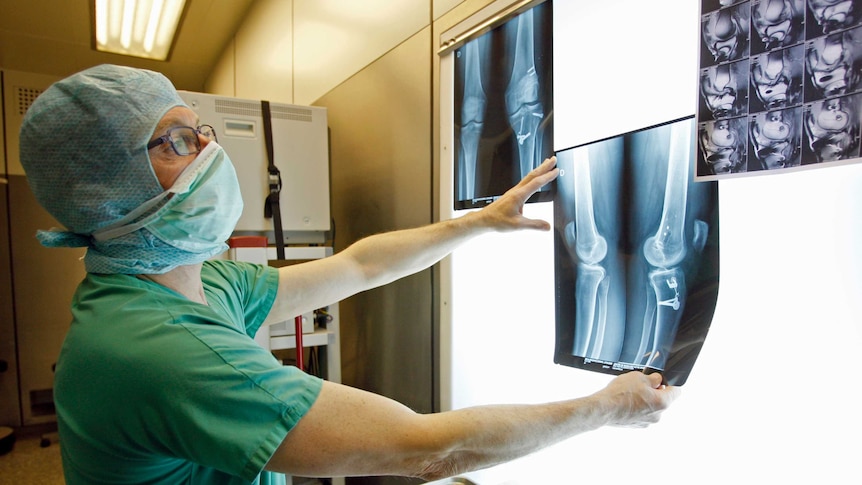 A surgeon looks at an x-ray of knees