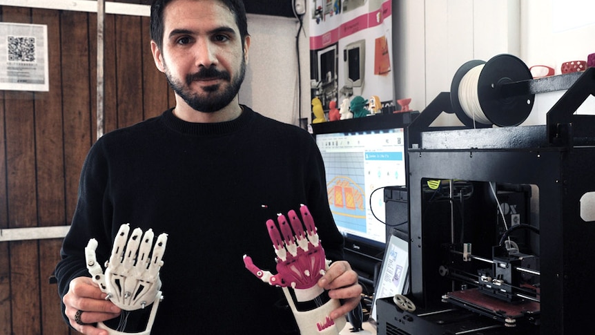 A prosthetic hand made with a 3D printer for an an 11-year-old boy