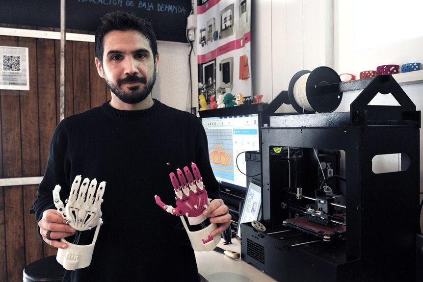 A prosthetic hand made with a 3D printer for an an 11-year-old boy
