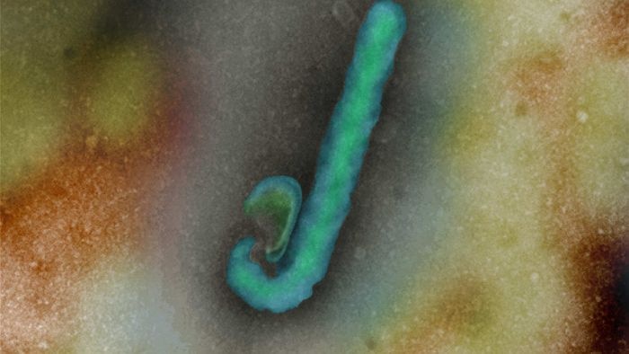 Ebola virus