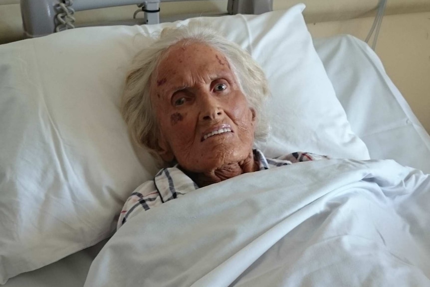 Fay Sherret being treated in hospital