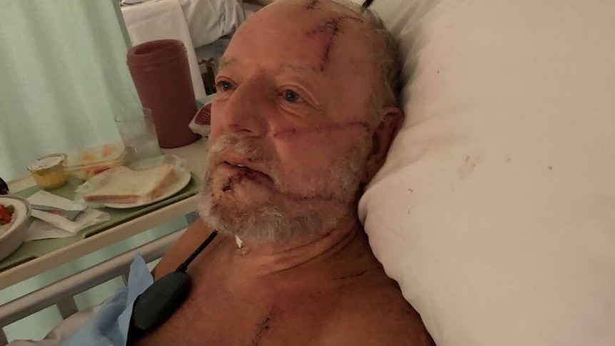 A man in hospital talks about his recovery from a machete attack