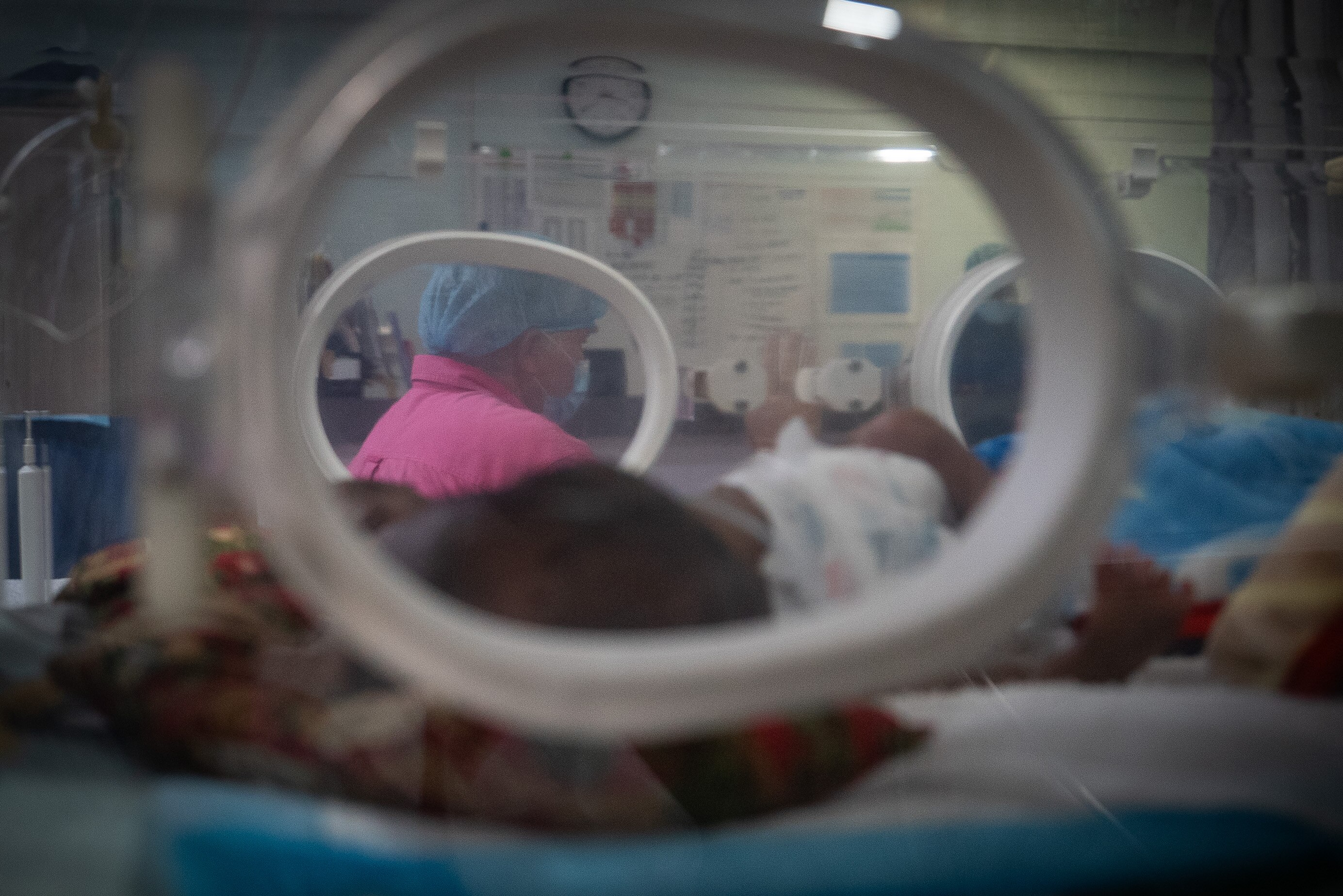 Gemelos siameses en una incubadora. Al otro lado se puede ver al personal del hospital.