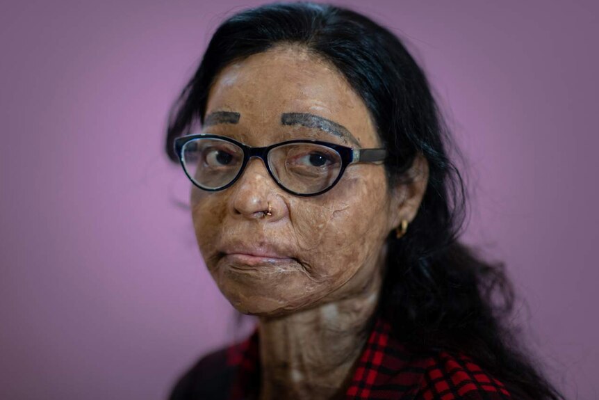 Nepalese Mum Sleeping X - Indian acid attacks are on the rise, and the women who survive them are  forced to live as outcasts - ABC News