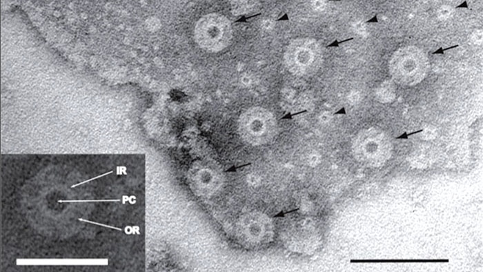 Close-up of Gemmata obscuriglobus bacterium