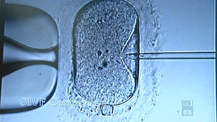 There have been about 10,000 IVF births in Australia.