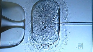 Close up of in vitro fertilisation