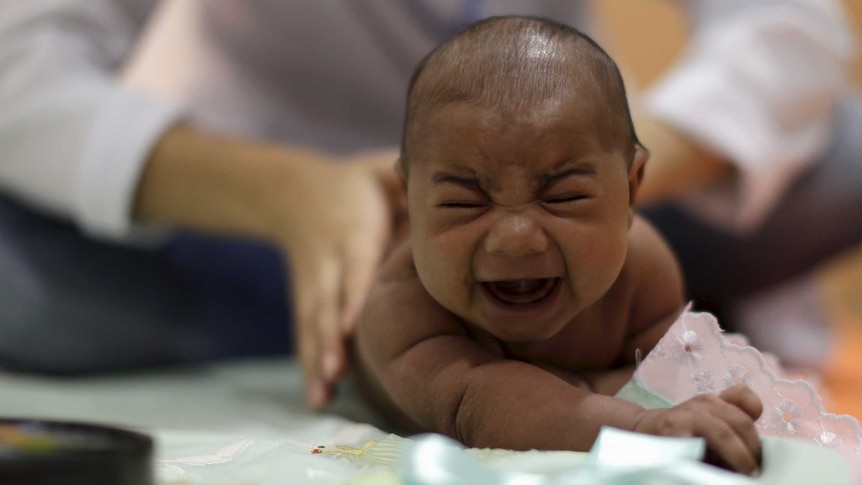 Baby with microcephaly in Brazil