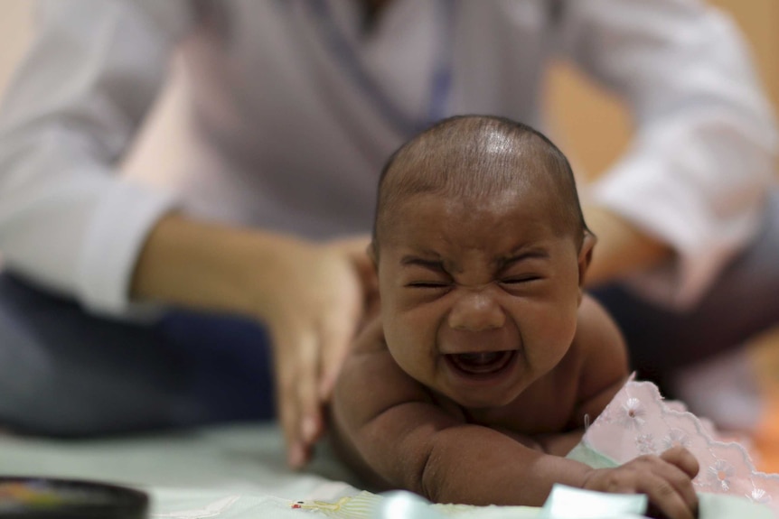 Baby with microcephaly in Brazil