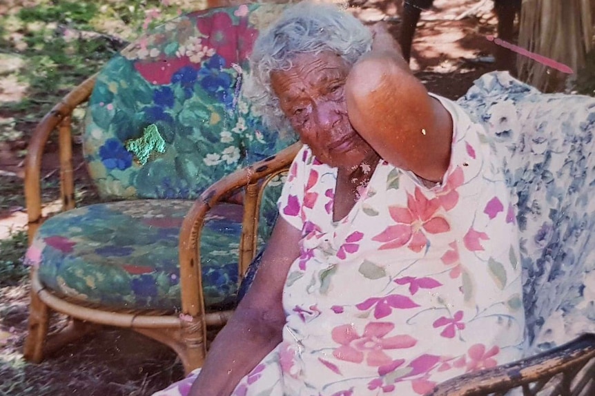 Daisy sits in a chair outside with her hand on her head, looking at the camera.