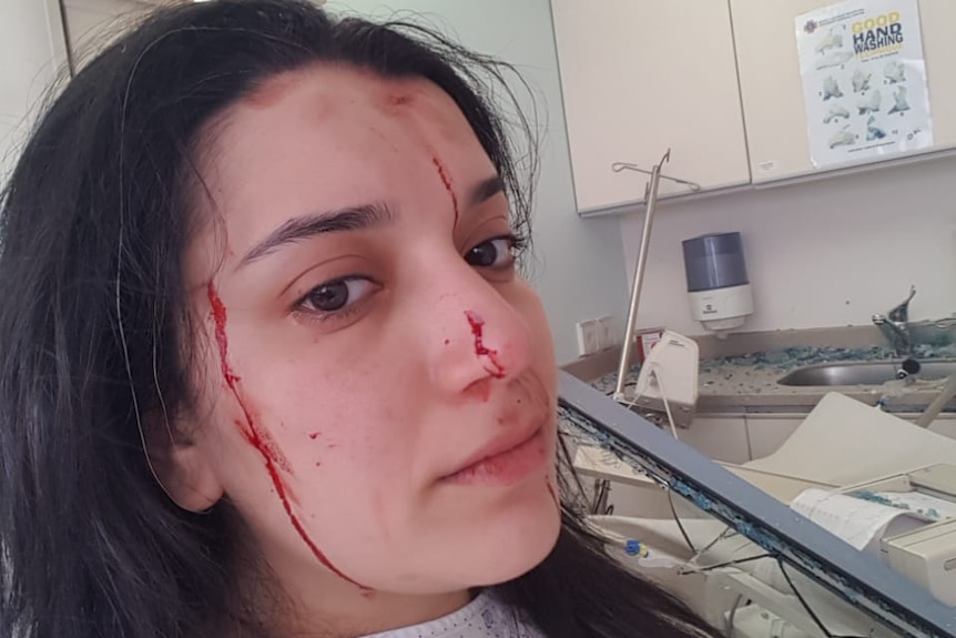 A woman with black hair looks away with blood dripping down her face as she lays on a hospital bed.