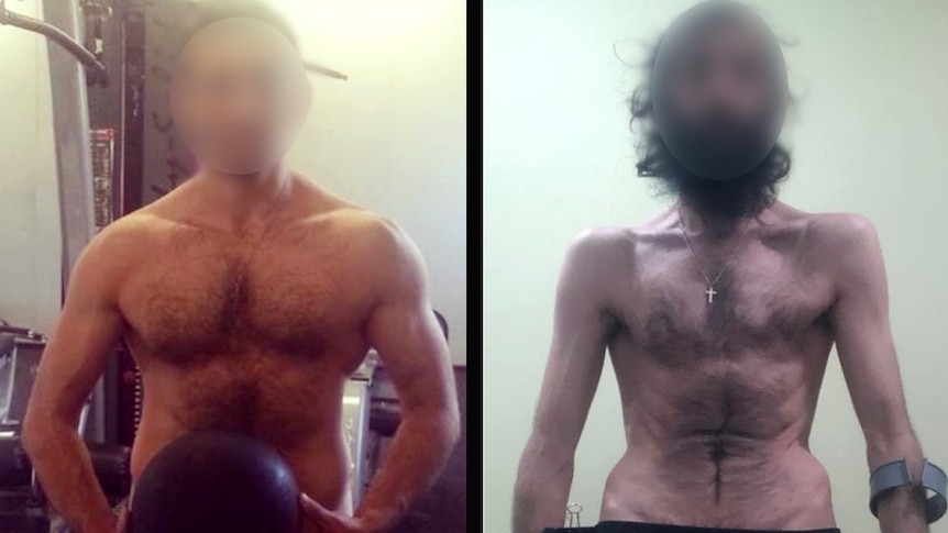 A before-and-after shot of a man's body which goes from muscular to emaciated.