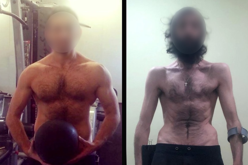 A before-and-after shot of a man's body which goes from muscular to emaciated.