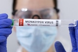 A person in medical glasses holds up a test tube with the words "monkeypox virus" on it. 