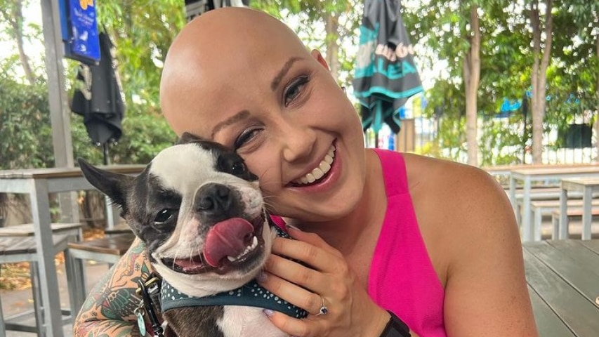 Katie Hale, who was diagnosed with alopecia areata in 2015.
