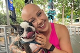 Katie Hale, who was diagnosed with alopecia areata in 2015.