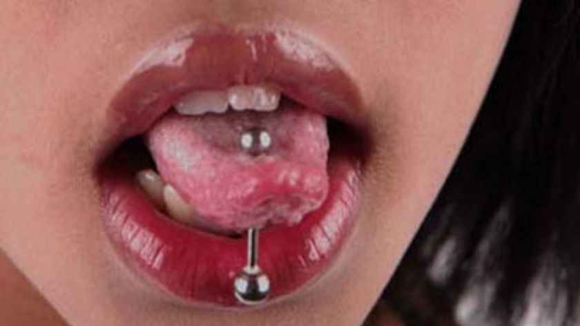 Generic close-up of a pierced tongue