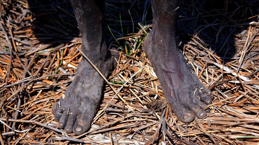 The bare feet of Robert Gaykamangu