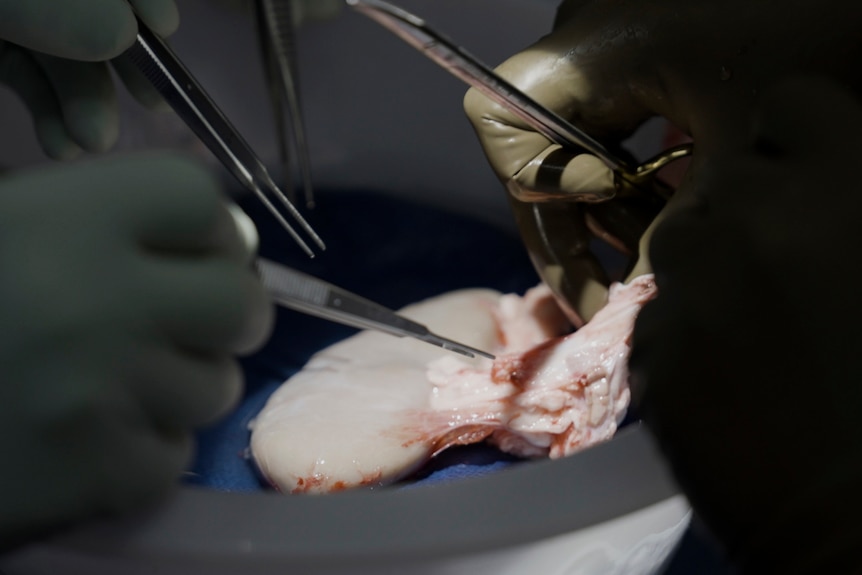 A close-up of scientists prodding a pig kidney with instruments