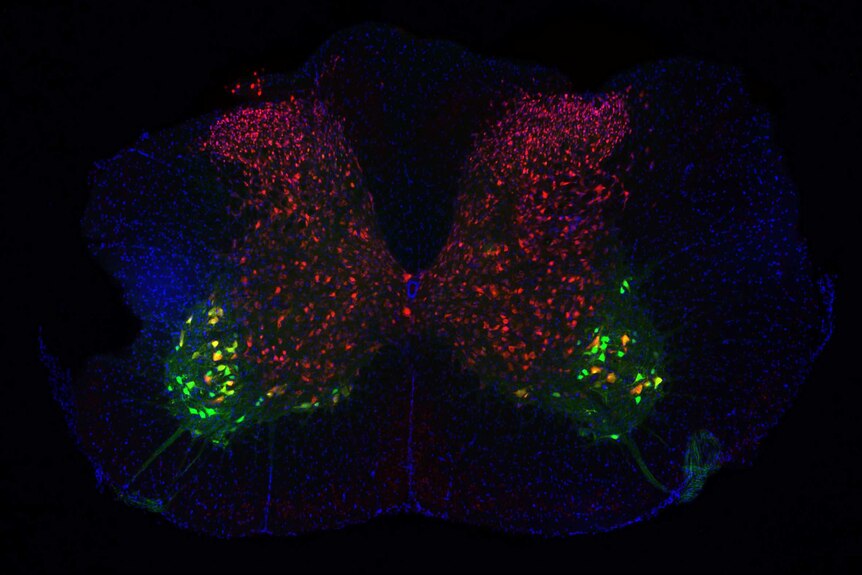 An image showing neurons on a mouse's spinal cord.