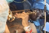 Dan Fabbio plays the saxophone while undergoing brain surgery.