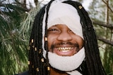 A man is smiling with gold grills, his face is covered in a white bandage, with only his right eye, nose and mouth visible.