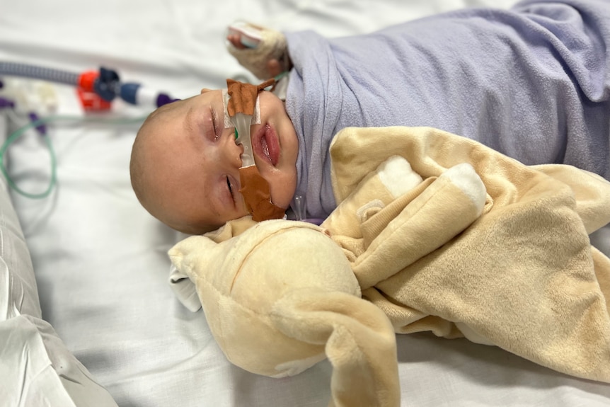A baby in a hospital bed with breathing tubes in its nose