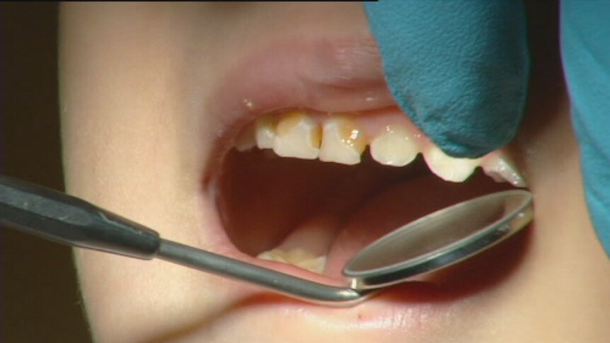 Child's teeth are being examined