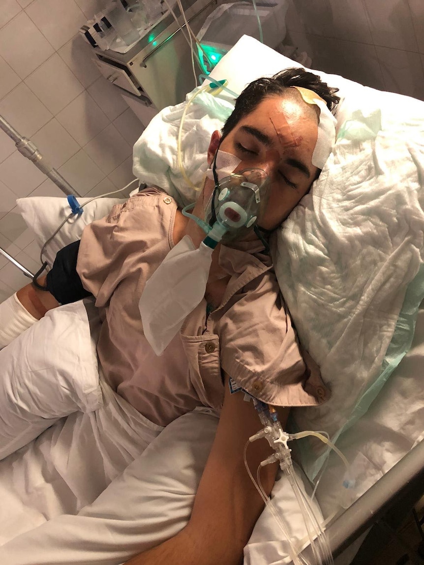 A young man in a hospital bed, with head injuries and a breathing tube.