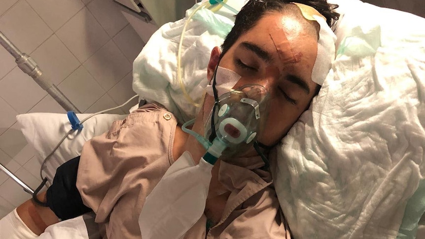 A young man in a hospital bed, with head injuries and a breathing tube.