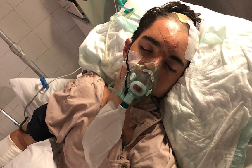A young man in a hospital bed, with head injuries and a breathing tube.