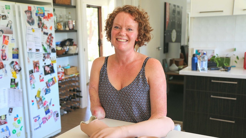 Mandy McCracken seated at a bench with her prosthetic limbs.