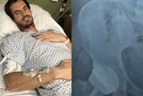 a photo of Andy Murray recovering in hospital next to an x-ray of his hip