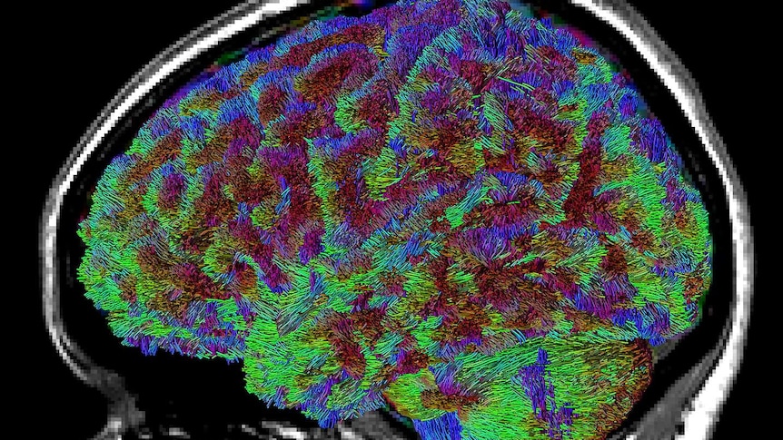 3D image of an anatomical scan with colours highlighting different parts