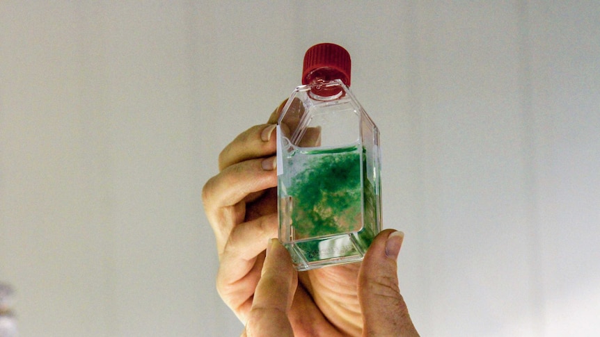 A bottle containing a cloud of blue-green algae suspended in water is held up to the light by a pair of hands
