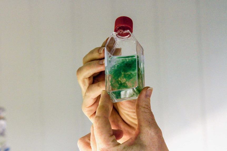 A bottle containing a cloud of blue-green algae suspended in water is held up to the light by a pair of hands