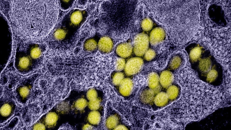 Colour-enhanced transmission electron micrograph of SARS-CoV-2 virus particles, isolated from a patient.