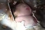 Hospital workers and fire fighters free a newborn baby from sewer pipes